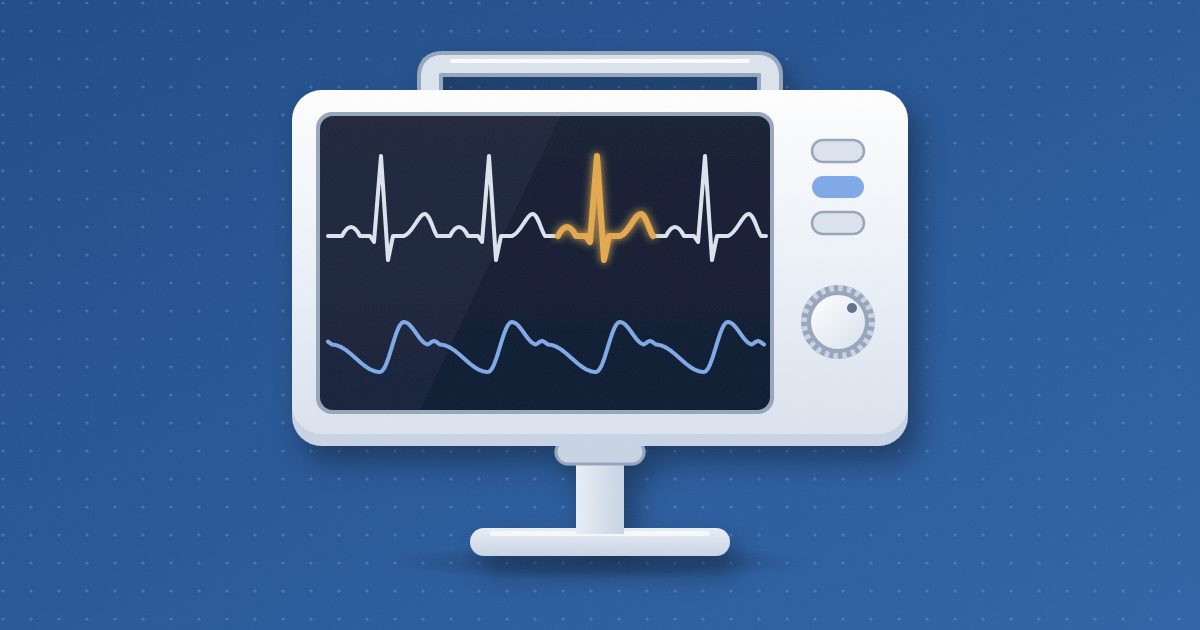 A bedside cardiac monitor on a short stand, its dark screen showing a pale blue rhythm strip with one beat glowing amber above a pulse wave.